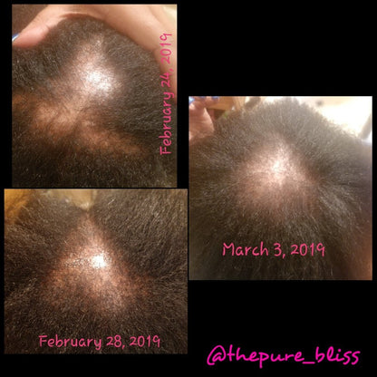 Hair Growth Oil - Pureblissllc